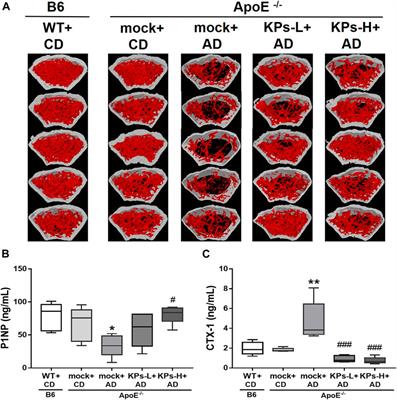 Kefir peptides attenuate atherosclerotic vascular calcification and osteoporosis in atherogenic diet-fed ApoE−/− knockout mice